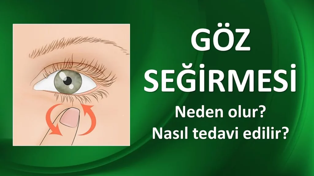 Göz Seğirmesi Nedir? Nasıl Geçer?